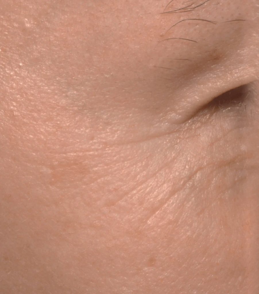 Masque led avant patte d'oie