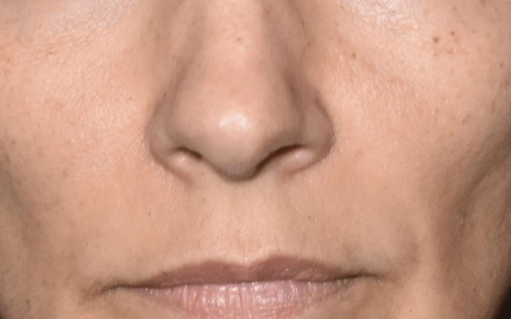 Masque led après