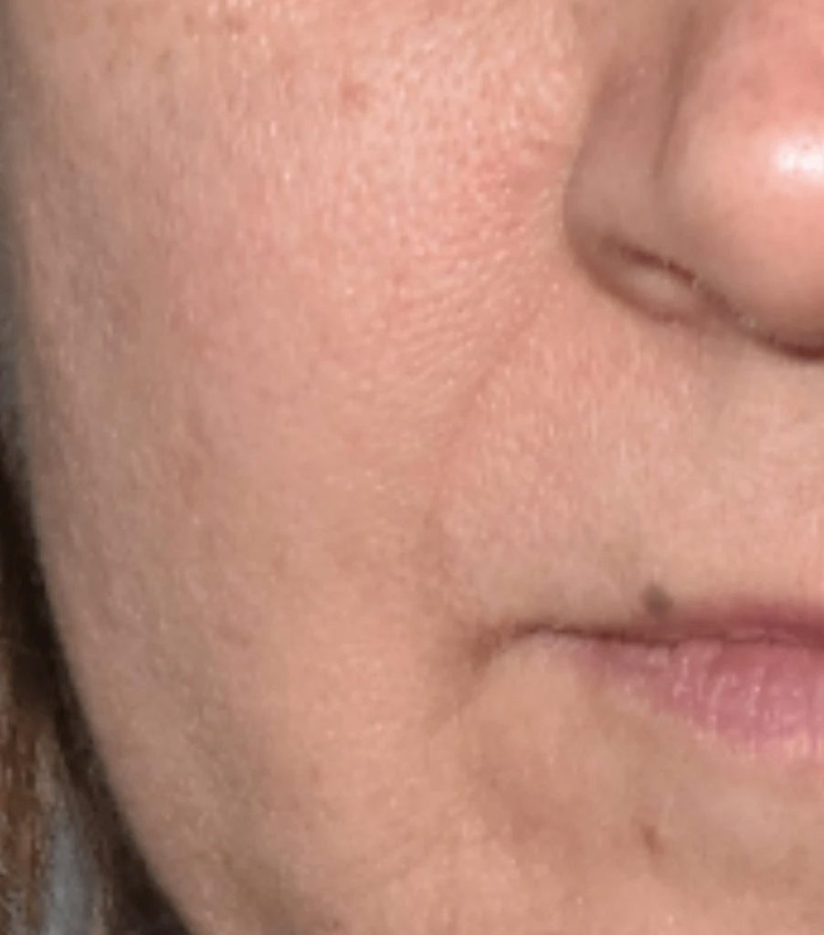 MASQUE LED AVANT SILLONS