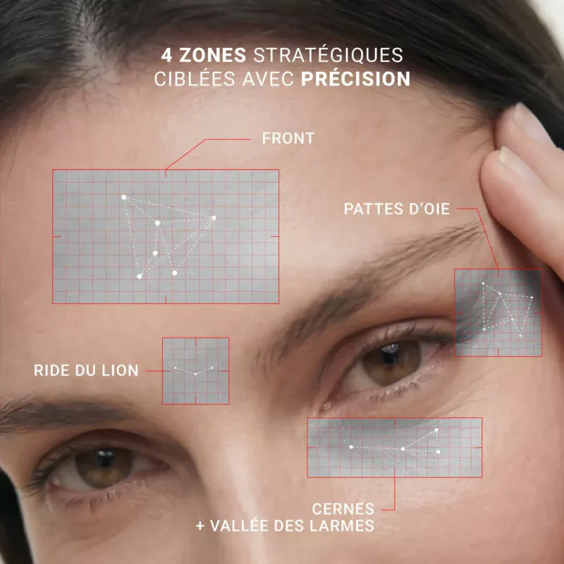 Zones ciblées par le masque LED Yeux X200 NOOĀNCE : front, ride du lion, pattes d’oie, cernes et vallée des larmes.